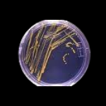 Professionelle Unterst&uuml;tzung durch Fa. Akut