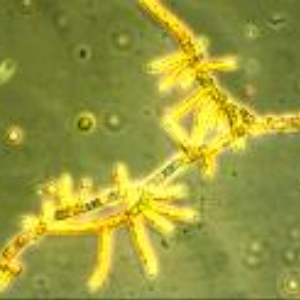 SCHIMMELPILZE &ndash; ALLGEMEINE INFORMATIONEN